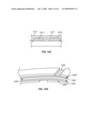 Electrical mapping and cryo ablating with a balloon catheter diagram and image