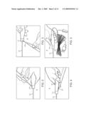 Surgical Instrument and Method diagram and image