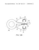 Surgical Instrument and Method diagram and image