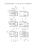 INFLATABLE MEDICAL DEVICES diagram and image