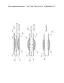 INFLATABLE MEDICAL DEVICES diagram and image