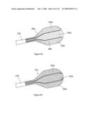 INFLATABLE MEDICAL DEVICES diagram and image