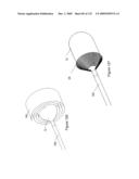 INFLATABLE MEDICAL DEVICES diagram and image