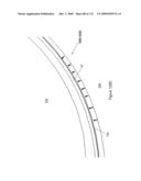 INFLATABLE MEDICAL DEVICES diagram and image