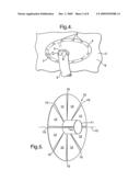 Reinforcement Device diagram and image