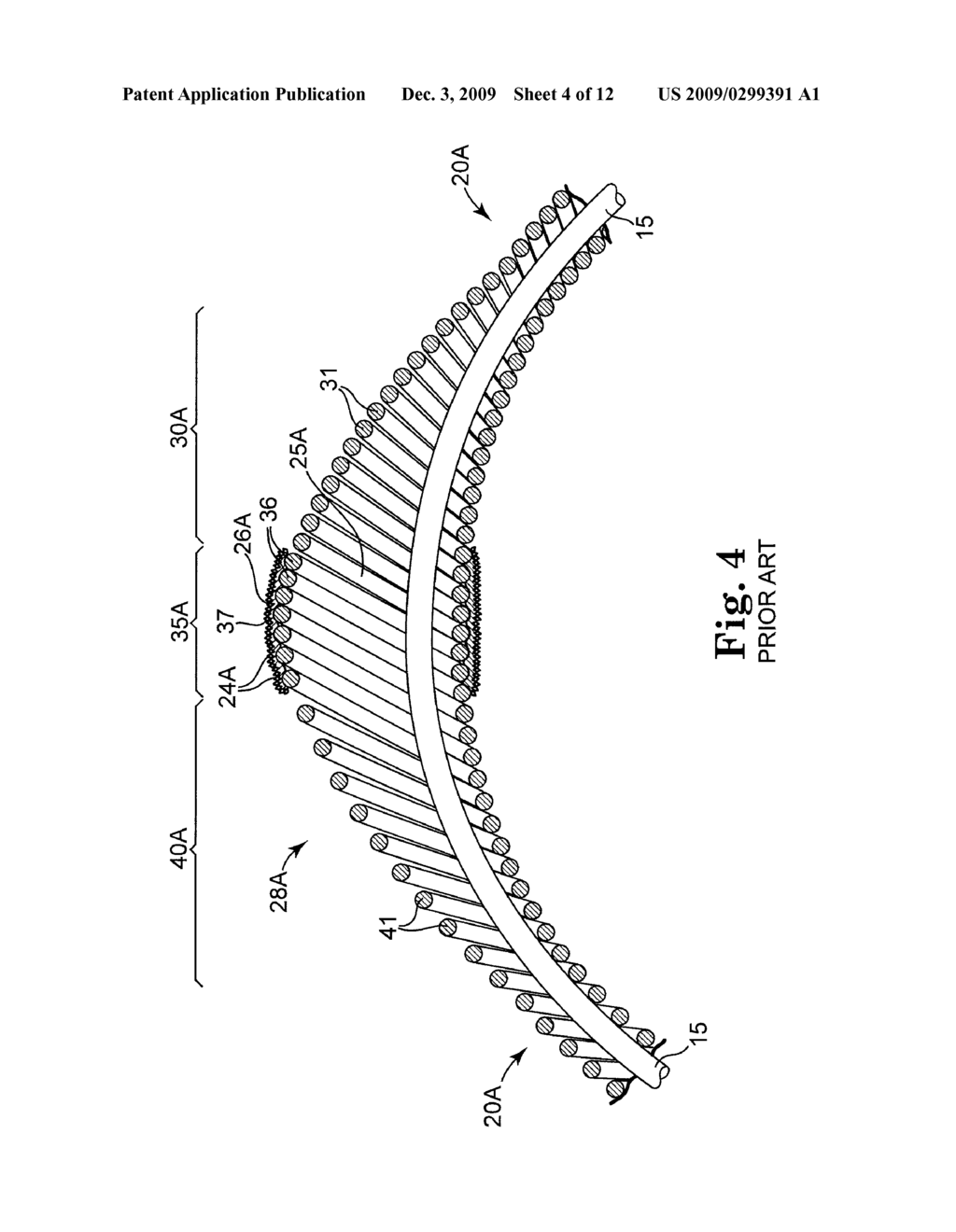 ECCENTRIC ABRADING AND CUTTING HEAD FOR HIGH-SPEED ROTATIONAL ATHERECTOMY DEVICES - diagram, schematic, and image 05