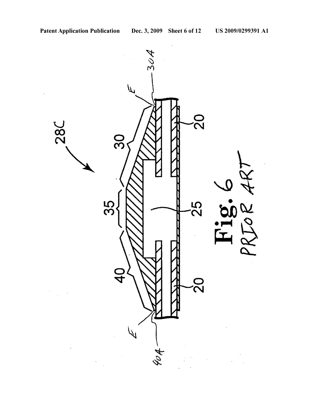 ECCENTRIC ABRADING AND CUTTING HEAD FOR HIGH-SPEED ROTATIONAL ATHERECTOMY DEVICES - diagram, schematic, and image 07