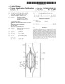 INSTRUMENT FOR DILATING BLOOD CHANNEL AND INSTRUMENT FOR TREATING AORTIC DISSECTION diagram and image