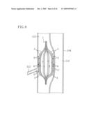 INSTRUMENT FOR DILATING BLOOD CHANNEL AND INSTRUMENT FOR TREATING AORTIC DISSECTION diagram and image