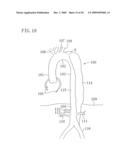 INSTRUMENT FOR DILATING BLOOD CHANNEL AND INSTRUMENT FOR TREATING AORTIC DISSECTION diagram and image