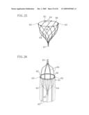 INSTRUMENT FOR DILATING BLOOD CHANNEL AND INSTRUMENT FOR TREATING AORTIC DISSECTION diagram and image