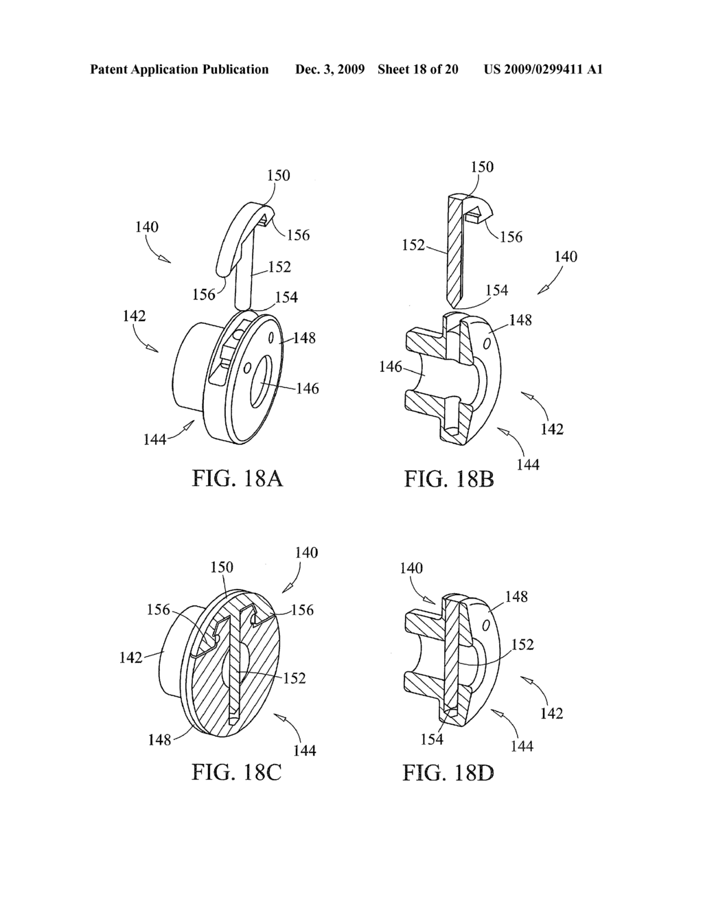 System and Method for Replacement of Spinal Motion Segment - diagram, schematic, and image 19