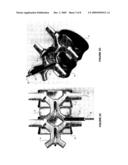 PERCUTANEOUS FACET JOINT FUSION SYSTEM AND METHOD diagram and image