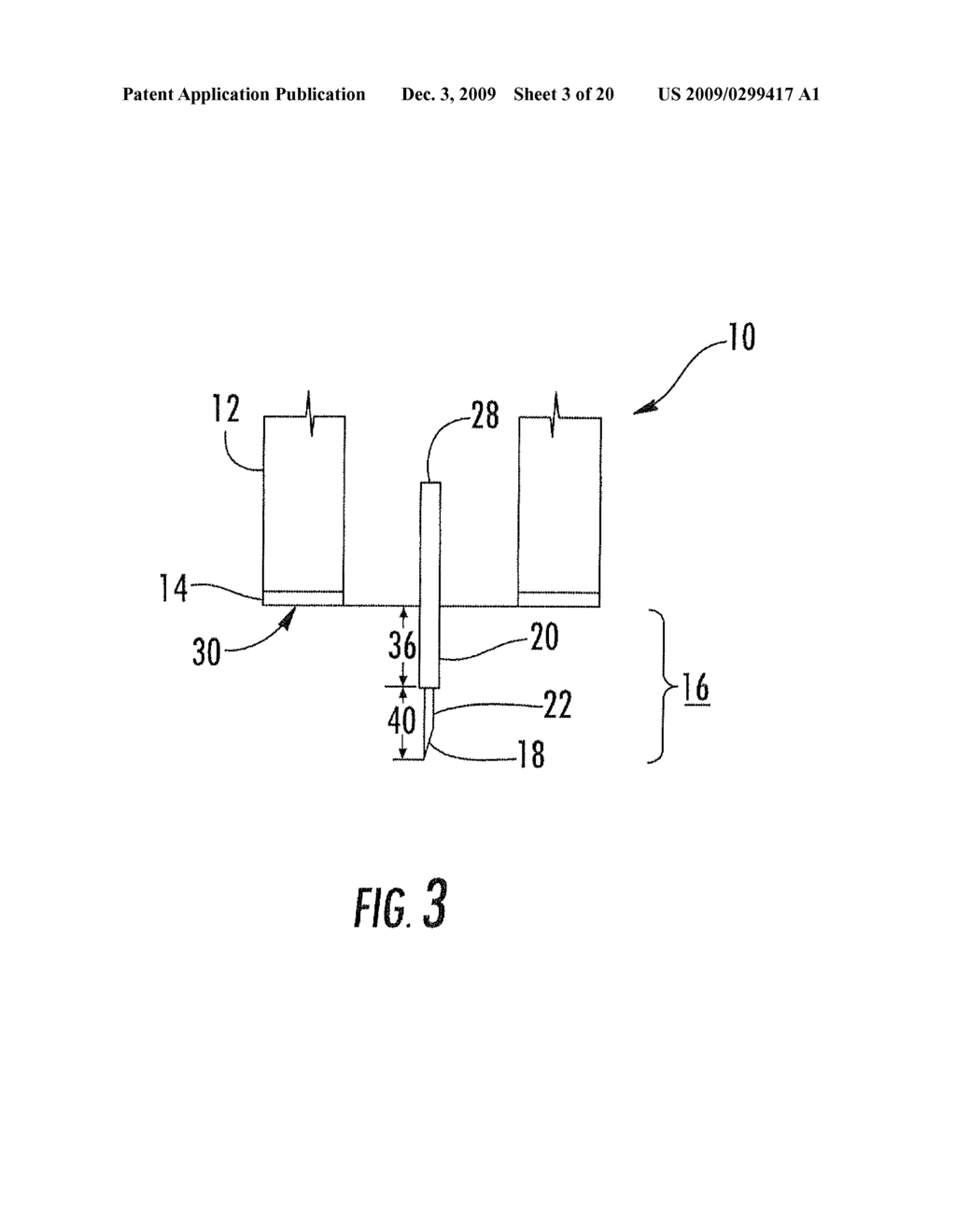 DELIVERY DEVICE, SYSTEM, AND METHOD FOR DELIVERING NANOSECOND PULSED ELECTRIC FIELDS - diagram, schematic, and image 04