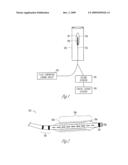 METHOD AND APPARATUS FOR CRYOTHERAPY AND PACING PRECONDITIONING diagram and image