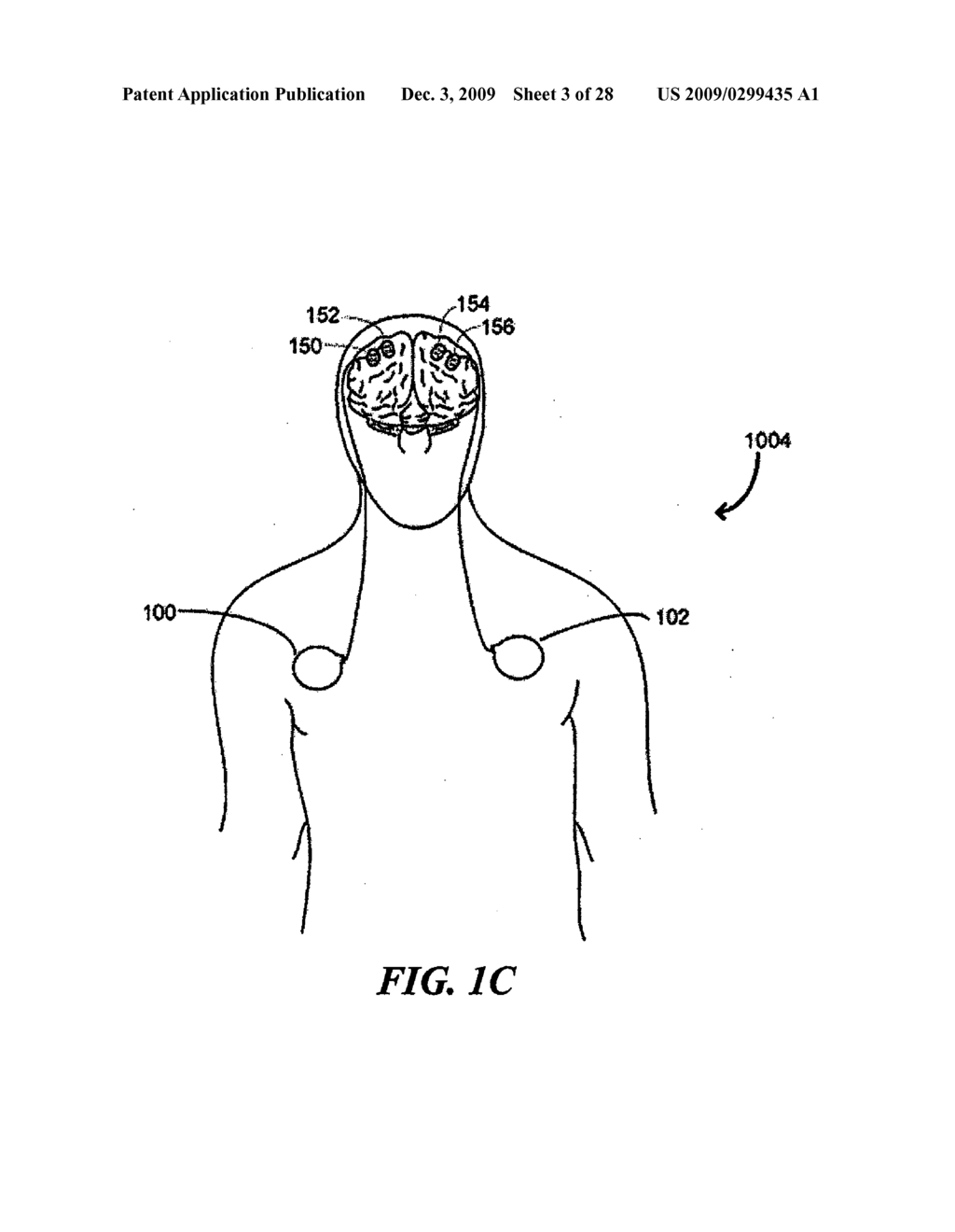 Systems and Methods for Enhancing or Affecting Neural Stimulation Efficiency and/or Efficacy - diagram, schematic, and image 04