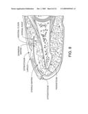 Near Infrared Microbial Elimination Laser Systems (NIMEL) diagram and image