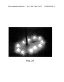 Near Infrared Microbial Elimination Laser Systems (NIMEL) diagram and image