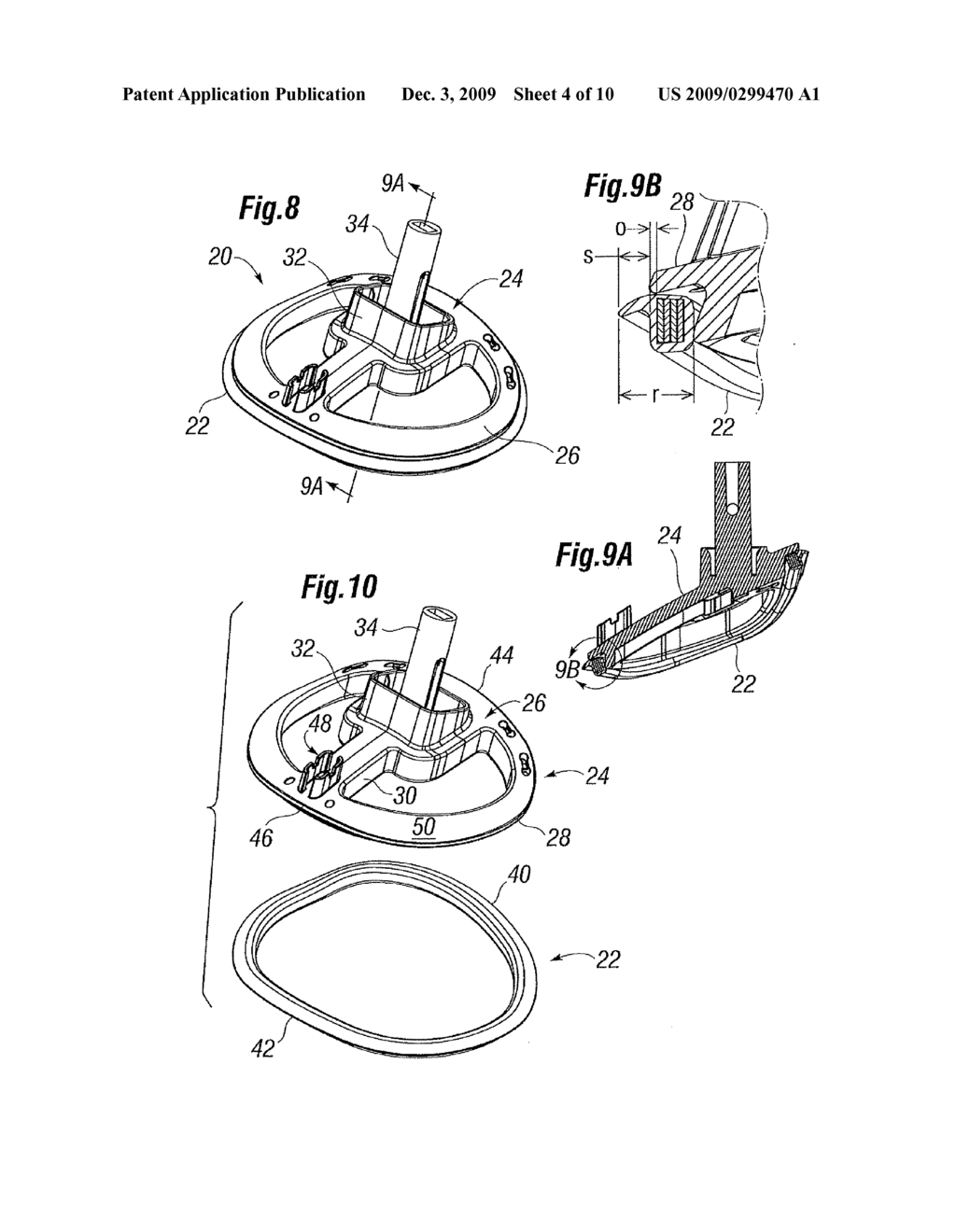 Quick-Release Annuloplasty Ring Holder - diagram, schematic, and image 05