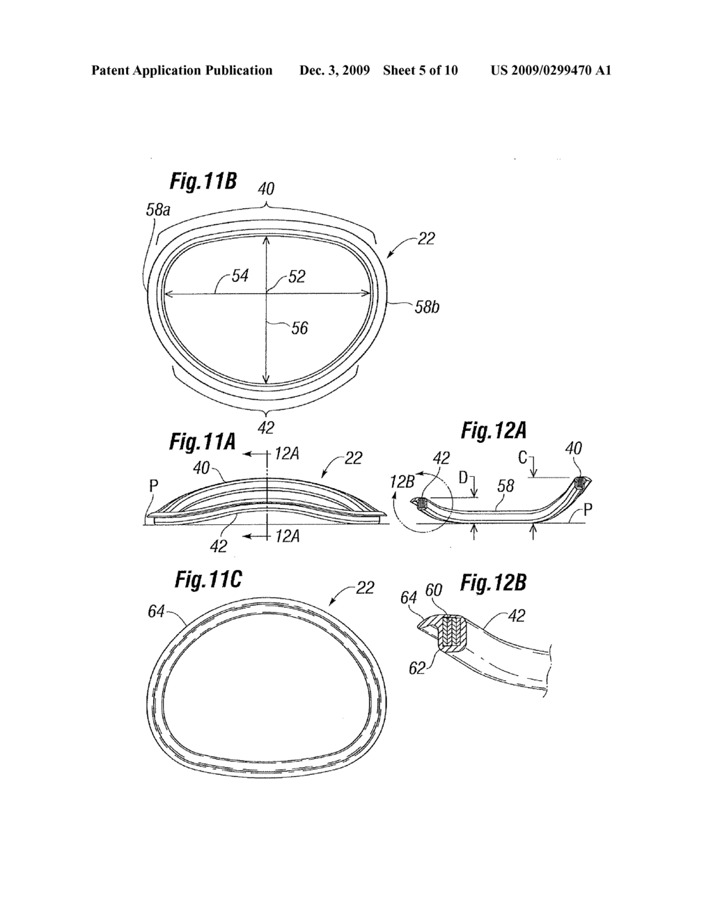 Quick-Release Annuloplasty Ring Holder - diagram, schematic, and image 06