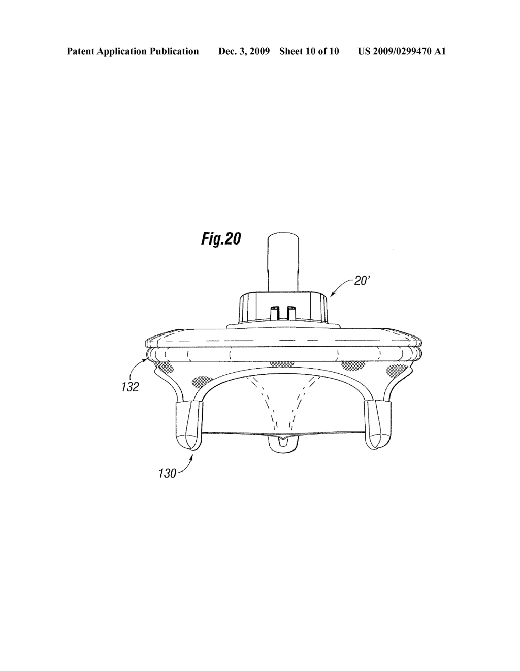 Quick-Release Annuloplasty Ring Holder - diagram, schematic, and image 11