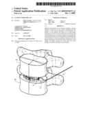 SUTURE GUIDED IMPLANT diagram and image