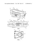 SUTURE GUIDED IMPLANT diagram and image