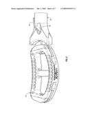 SUTURE GUIDED IMPLANT diagram and image