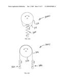 Joint Actuation Mechanism for a Prosthetic and/or Orthotic Device Having a Compliant Transmission diagram and image