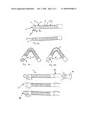 PROSTATIC STENT diagram and image