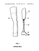 PROSTHETIC LIMB diagram and image