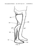 PROSTHETIC LIMB diagram and image