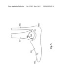 PROSTHETIC LIMB diagram and image