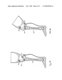 PROSTHETIC LIMB diagram and image