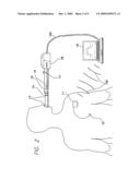 METHODS AND APPARATUS FOR NON-INVASIVE IMPLANTABLE PRESSURE SENSOR CALIBRATION diagram and image