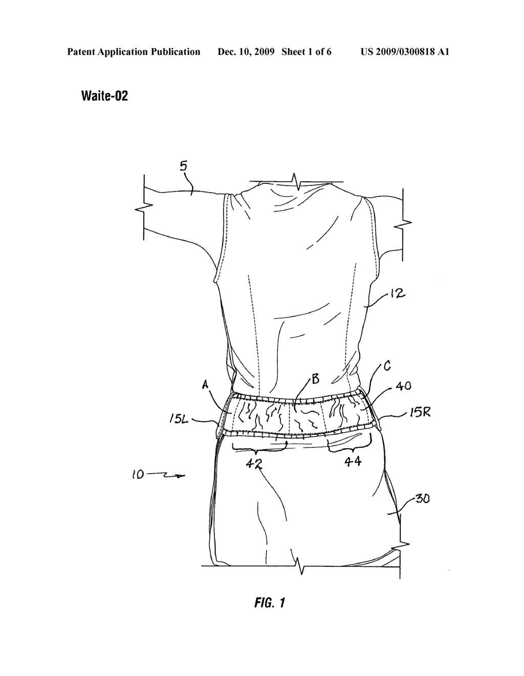 Tennis garment with ball sleeves - diagram, schematic, and image 02