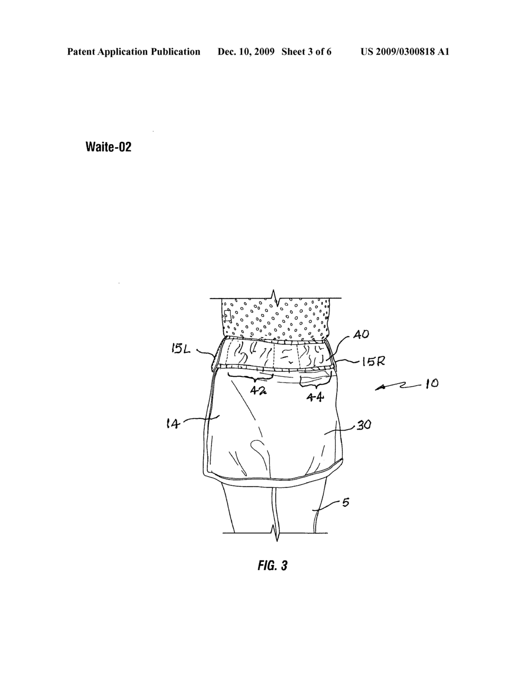 Tennis garment with ball sleeves - diagram, schematic, and image 04