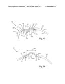 PROTECTIVE GLOVE HAVING SEGMENTED WRIST GUARD diagram and image