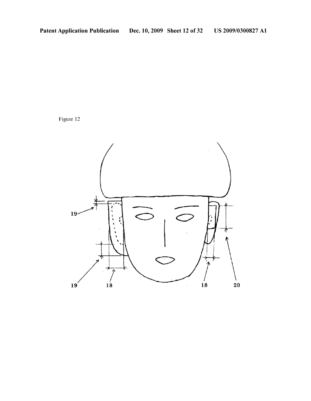 DEVICE REDUCING WIND NOISE - diagram, schematic, and image 13