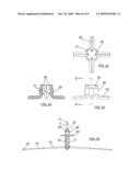 SUPPORT FOR STRAIGHT WIND INSTRUMENTS diagram and image