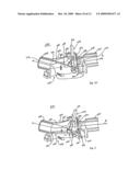 HEAT AND MOISTURE EXCHANGE UNIT WITH CHECK VALVE diagram and image