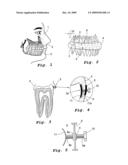 ARRANGEMENT FOR SECURING A TEETH SUPPORT diagram and image