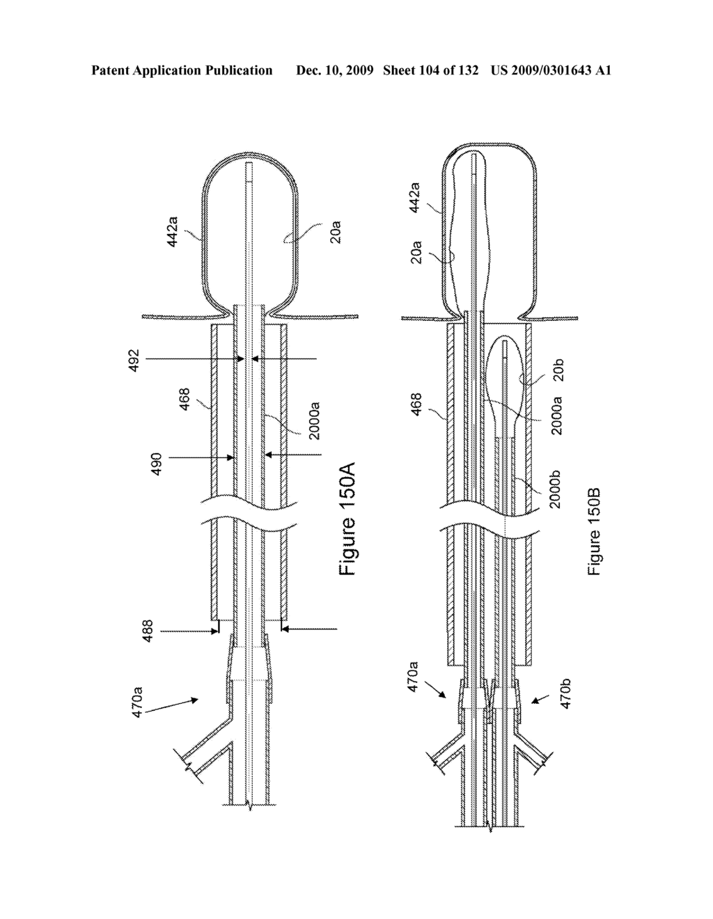 INFLATABLE MEDICAL DEVICES - diagram, schematic, and image 105