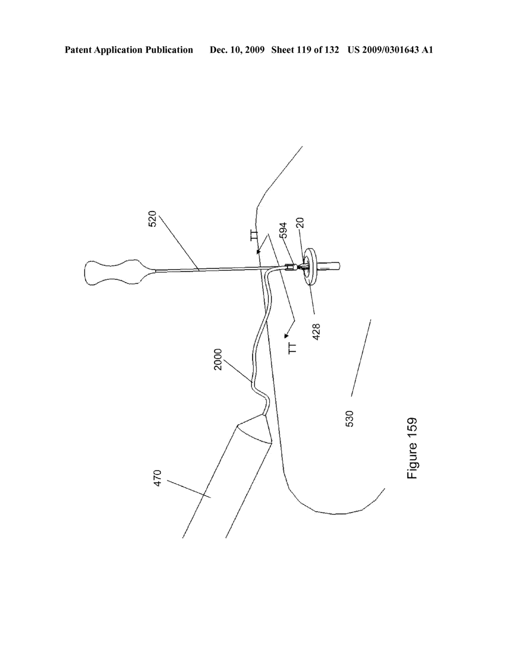 INFLATABLE MEDICAL DEVICES - diagram, schematic, and image 120