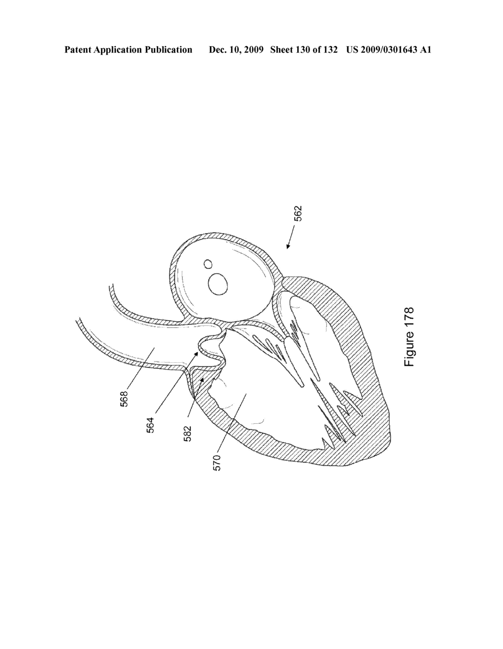 INFLATABLE MEDICAL DEVICES - diagram, schematic, and image 131