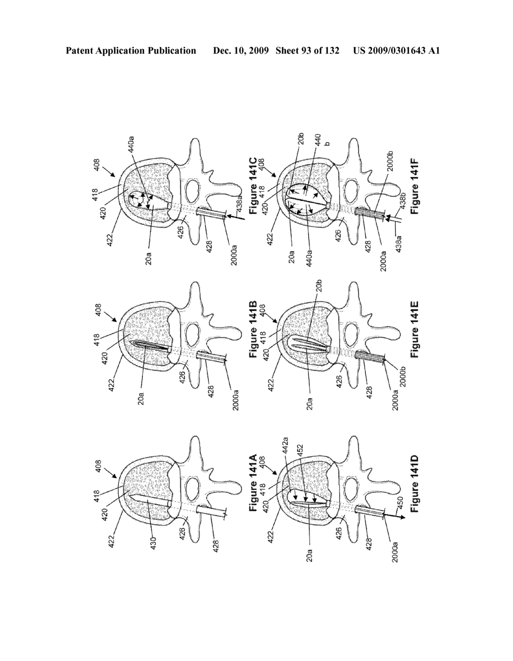 INFLATABLE MEDICAL DEVICES - diagram, schematic, and image 94