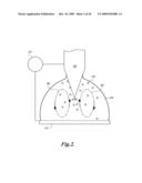 METHOD AND SYSTEM FOR CONCENTRATING PARTICLES FROM A SOLUTION diagram and image