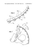 Holder for holding a tooth on a body of a cutting blade or grinding drum for cutting or grinding rock or hard earth formations diagram and image