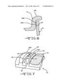 Vehicle Wheel Cover Retention System and Method for Producing Same diagram and image