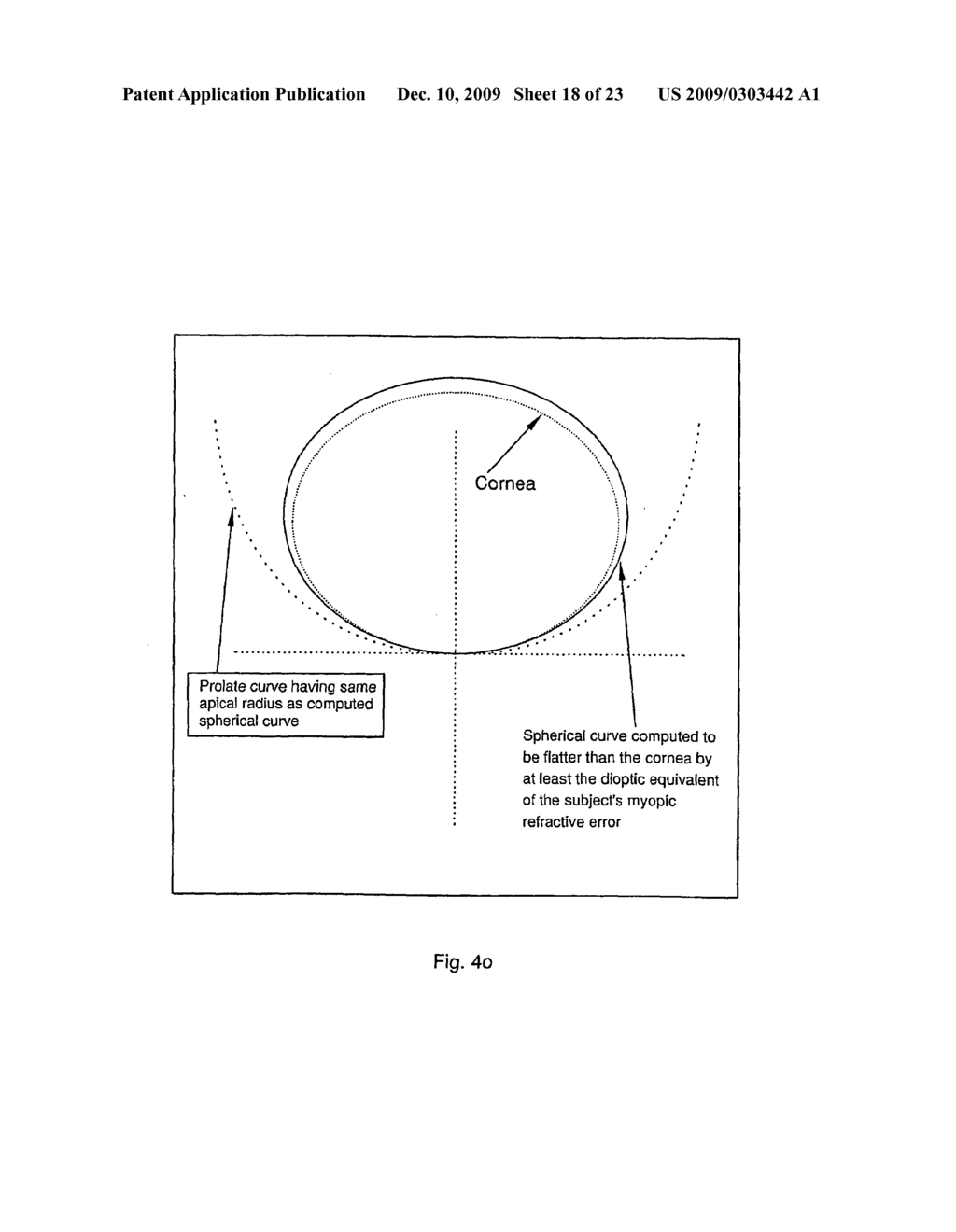 CORNEAL AND EPITHELIAL REMODELLING - diagram, schematic, and image 19